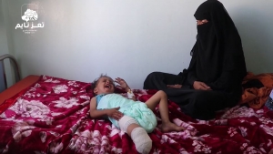 شاهد: قصة مأساوية لامرأة يمنية قتل الحوثيون أطفالها الثلاثة وفَقَد طفلها الرابع ساقه