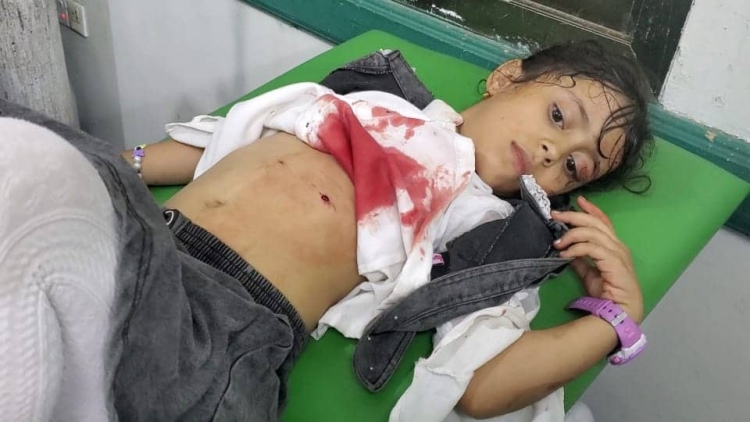 مقتل وإصابة 10 آلاف مدني في تعز جراء الحصار الحوثي منذ 7 سنوات
