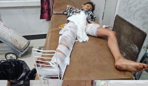 إصابة طفلين برصاص قناصة الحوثي غربي مدينة تعز
