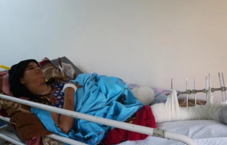 223 امرأة ضحية لألغام الحوثي في تعز خلال السنوات الماضية