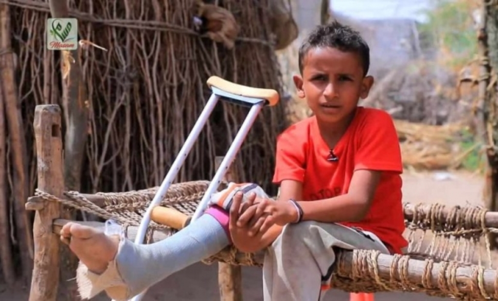 المرصد اليمني يوثق سقوط 15 ضحية من المدنيين بالألغام خلال شهر نوفمبر