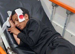 إصابة طفل برصاص قناص حوثي جنوب شرق تعز