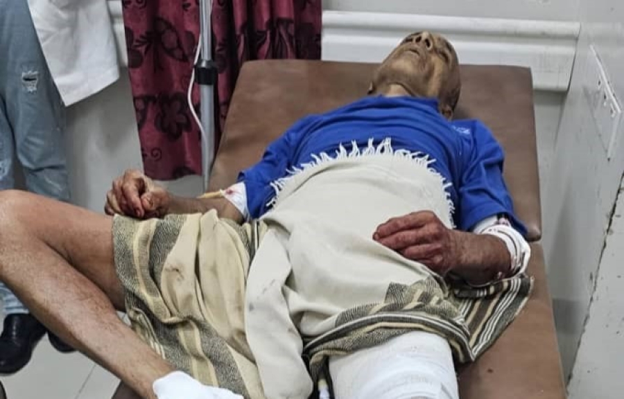 قناص حوثي يستهدف مواطنا جوار منزله شرقي تعز