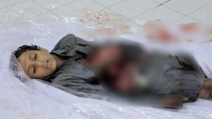 استشهاد ثلاثة مدنيين بينهم طفل يتيم بقصف حوثي صاروخي على مأرب
