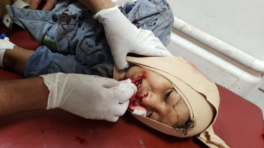 مقتل مدني وإصابة طفلين آخرين بقصف مدفعي ومسيّر للحوثيين في تعز