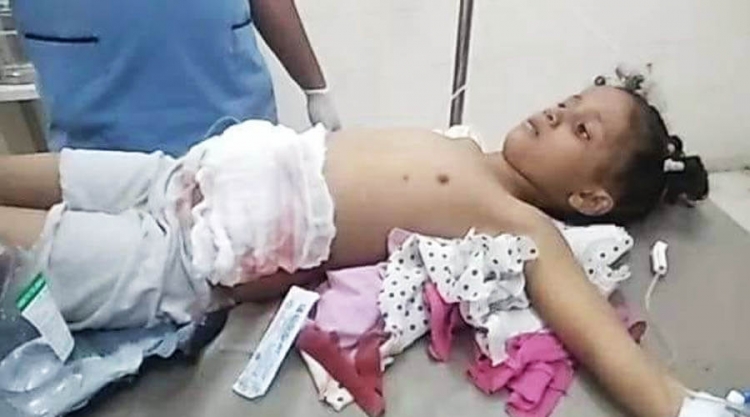 وفاة طفلة متأثرة بإصابتها برصاص قناص حوثي في تعز