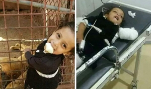 أسد يلتهم ذراع طفلة في اليمن