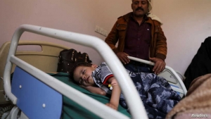 طفل يمني يعاني من عيب خلقي في القلب وغير قادر على العلاج
