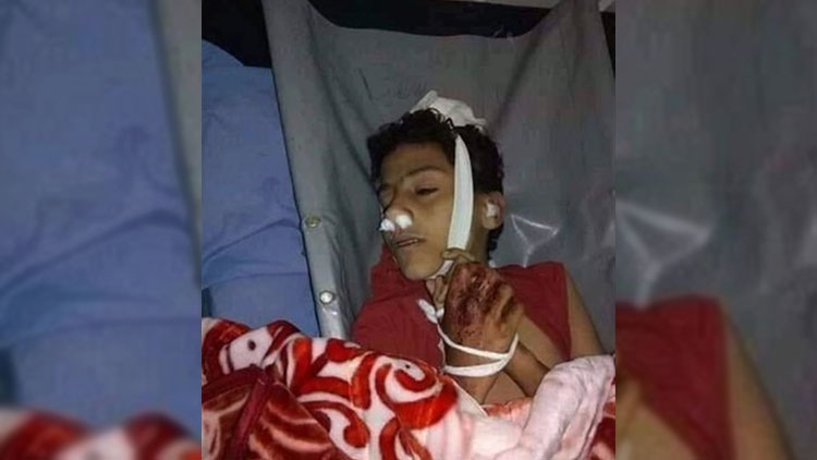 مليشيا الحوثي تفتح نيران أسلحتها على طفل وترديه قتيلاً في الحيمة بتعز