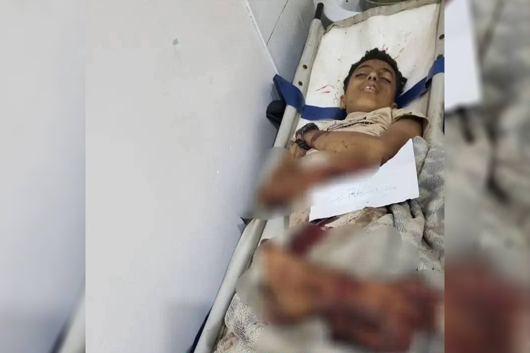 تقرير دولي: مقتل 5 أطفال بانفجار في تعز يُرفع حصيلة ضحايا الألغام من الأطفال إلى 40 منذ بداية 2025