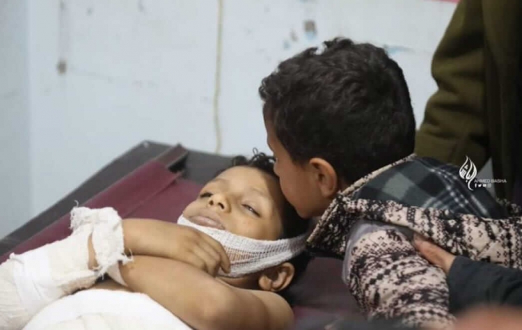 مقتل طفل بقذيفة حوثية وإصابة 2آخرين بتعز والجيش يصفها بجريمة حرب
