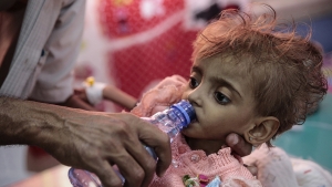 48 ألف طفل يعانون من سوء التغذية الحاد في مخيمات النزوح بـ مأرب