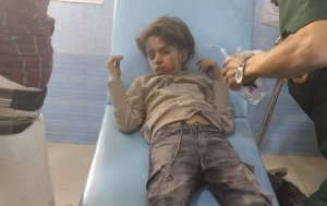 إصابة طفلين بقصف حوثي على الأحياء السكنية شرقي تعز