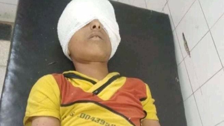 مصدر حقوقي لتعز تايم: مقتل طفل برصاص قناص حوثي