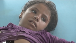 إصابة طفلة برصاص قناص حوثي في مديرية حيس بالحديدة