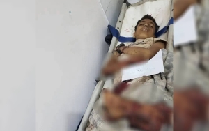 مقتل 5 أطفال جراء انفجار مقذوف من مخلفات الحرب في مديرية التعزية بمحافظة تعز