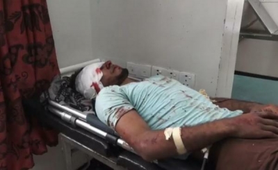 إصابة مدنيين اثنين برصاص قناصة الحوثيين شرقي مدينة تعز