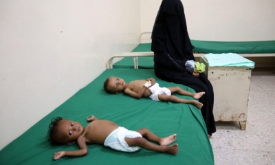 الأمم المتحدة: وفاة 6 أطفال من حديثي الولادة في اليمن كل ساعتين