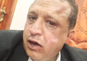 منظمتان حقوقيتان تدينان حادثة الاعتداء على الصحفي مجلي الصمدي بصنعاء