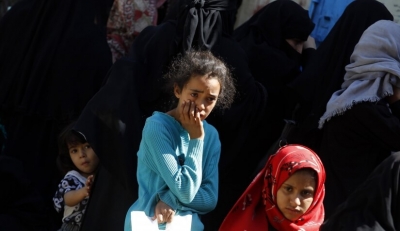 الأمم المتحدة تعلن زيادة حجم المساعدات في بؤر الجوع باليمن