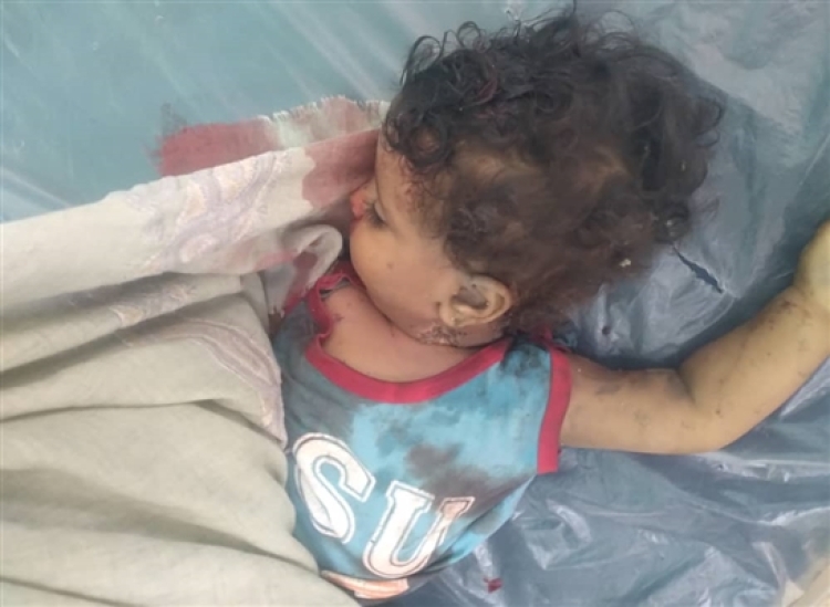 مقتل طفل وجندي بهجمات للحوثيين جنوبي تعز