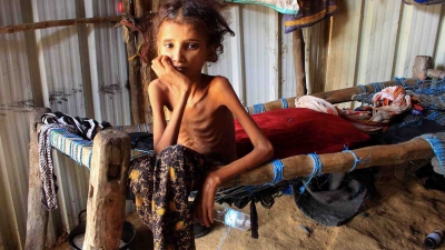 البنك الدولي: 70 بالمئة من اليمنيين يواجهون خطر الجوع