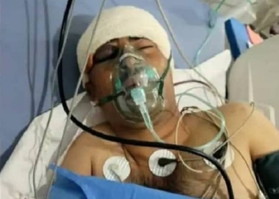 مسلحون في محافظة إب يعتدون على أحد الباعة بطريقة وحشية