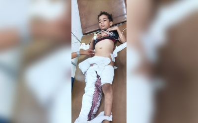 إصابة طفل بشظايا رصاص قناص حوثي شرقي تعز