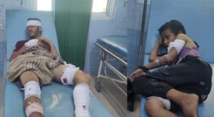 إصابة شقيقين إثر انفجار عبوة ناسفة من مخلفات الحرب شرقي تعز