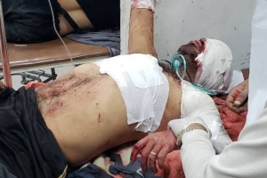 المليشيا تستهدف محطة وقود في تعز أسفر عن وفاة شخص وإصابة 25 آخرين حتى الآن