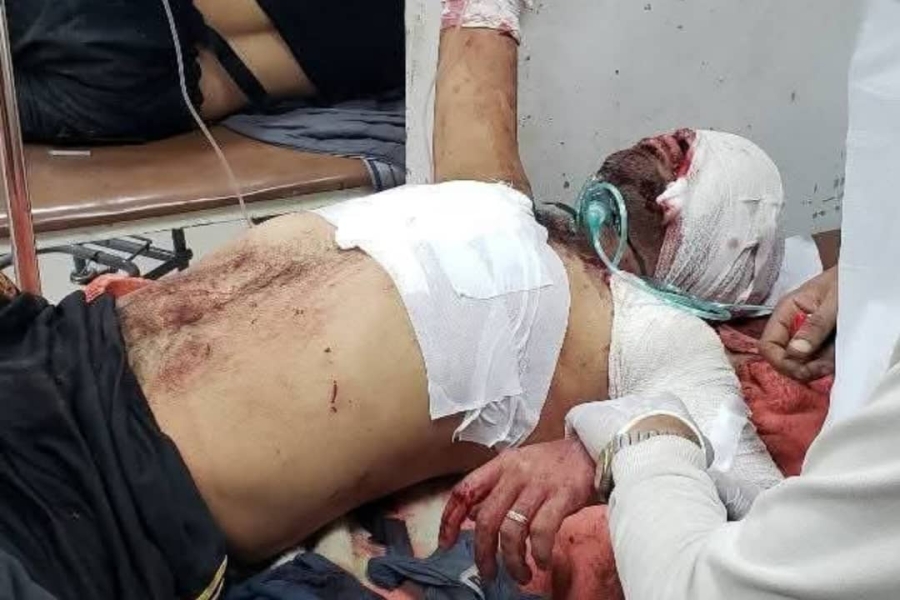 المليشيا تستهدف محطة وقود في تعز أسفر عن وفاة شخص وإصابة 25 آخرين حتى الآن