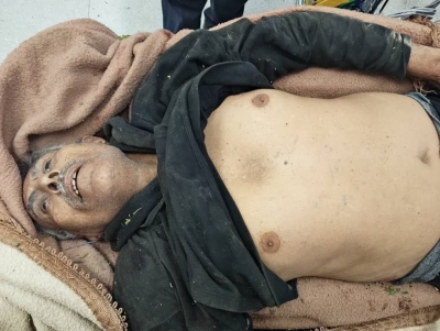 مقتل مدني برصاص قنّاص حوثي شرقي مدينة تعز