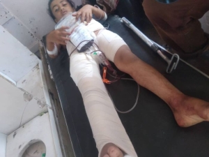 إصابة طفلة برصاص قناص حوثي شمالي محافظة الضالع