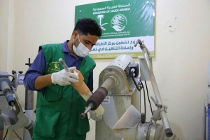 674 مستفيداً من الخدمات الطبية التي قدمها مركز الأطراف الصناعية بتعز خلال فبراير الماضي