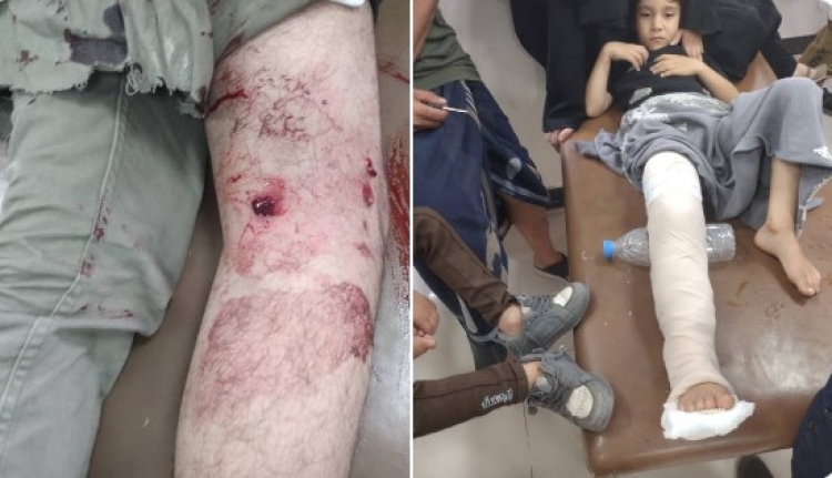 إصابة شخصين برصاص قناص أثناء جلبهما المياه من الحي المجاور شرقي مدينة تعز