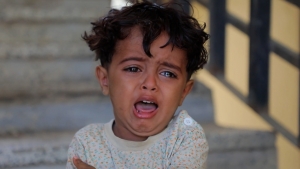 بالفيديو: قصة طفل من تعز عمره 4 سنوات دمر الحوثيون حياته وبتروا قدمه بقذيفة