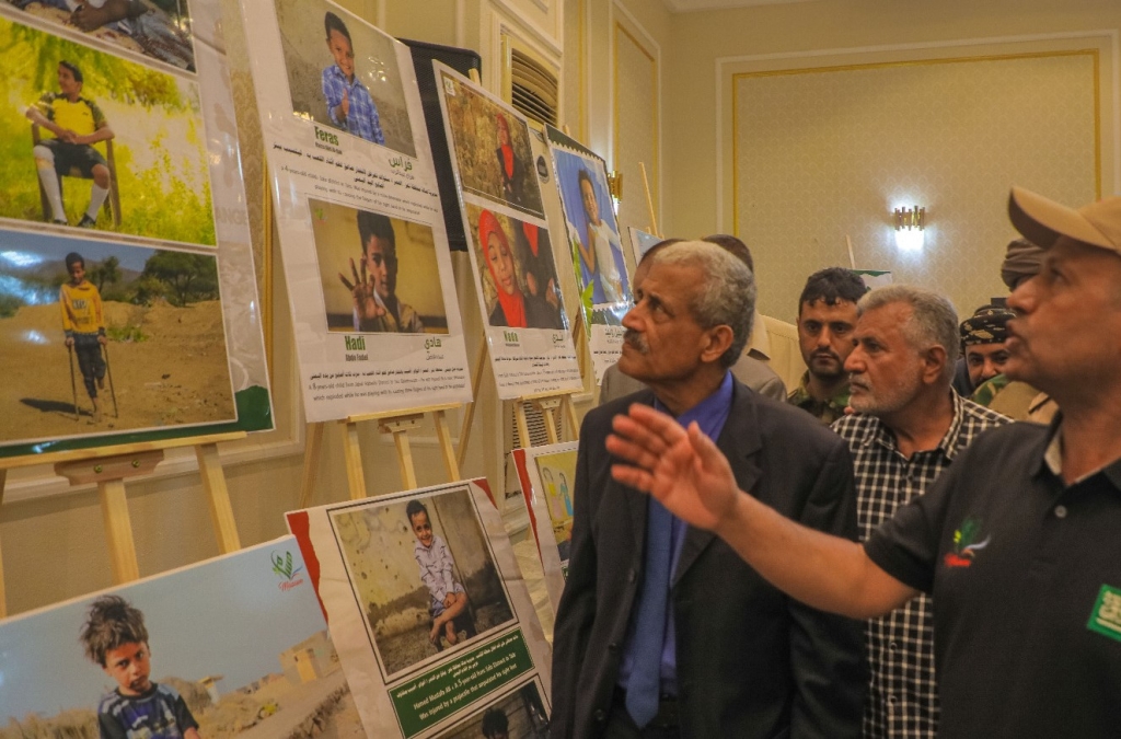 مشروع "مسام" لنزع الألغام يقيم معرض صور لضحايا الألغام من الأطفال في اليمن