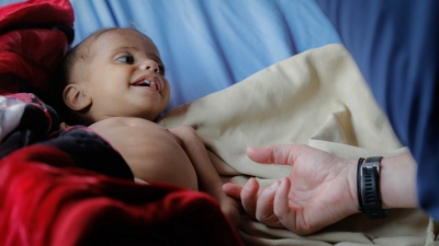 وزارة الصحة التابعة للحوثيين: وفاة نحو 170 طفلاً يوميًا