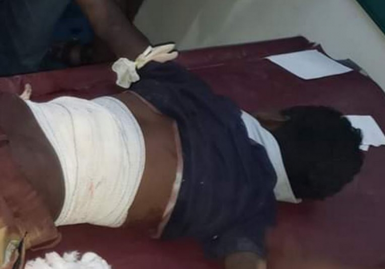 إصابة طفل في تعز برصاص قناص حوثي