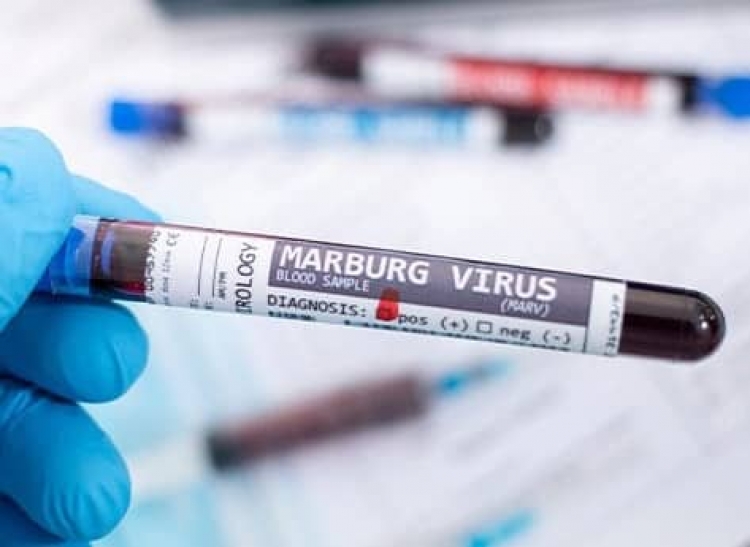 الصحة العالمية: قلقون من انتشار فايروس ‎ماربورغ عالميا