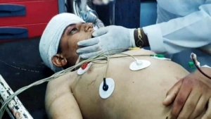 استشهاد طفل بقصف حوثي على مأرب ووفاة آخر بحريق في مخيم للنازحين