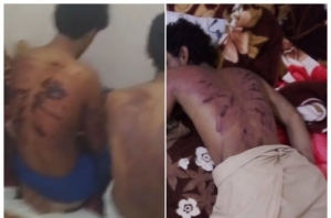 الحكومة اليمنية تؤكد متابعتها لواقعة تعذيب 7 من رعاياها في الأراضي العُمانية