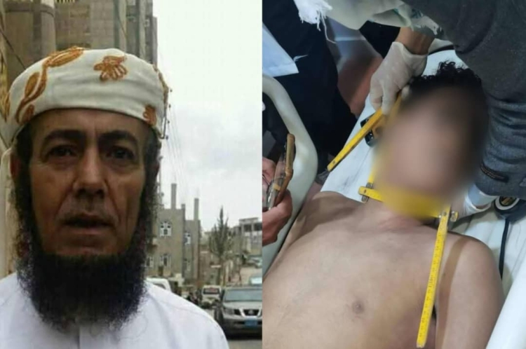 ضرب وخنق ينهيان حياة فتى في إب على يد قارئ رقية شرعية