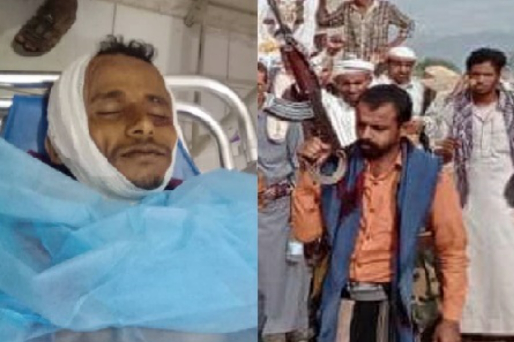 كان يحمل كيسا من العنب لأطفاله… المليشيا تقتل مواطنا أمام أسرته في مديرية جبل رأس بالحديدة