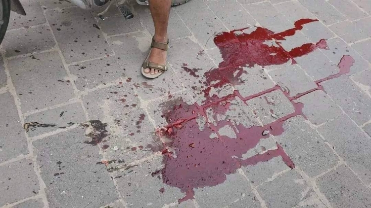 إصابة 12 طفلًا بقصف حوثي استهدف حي سكني وسط مدينة تعز
