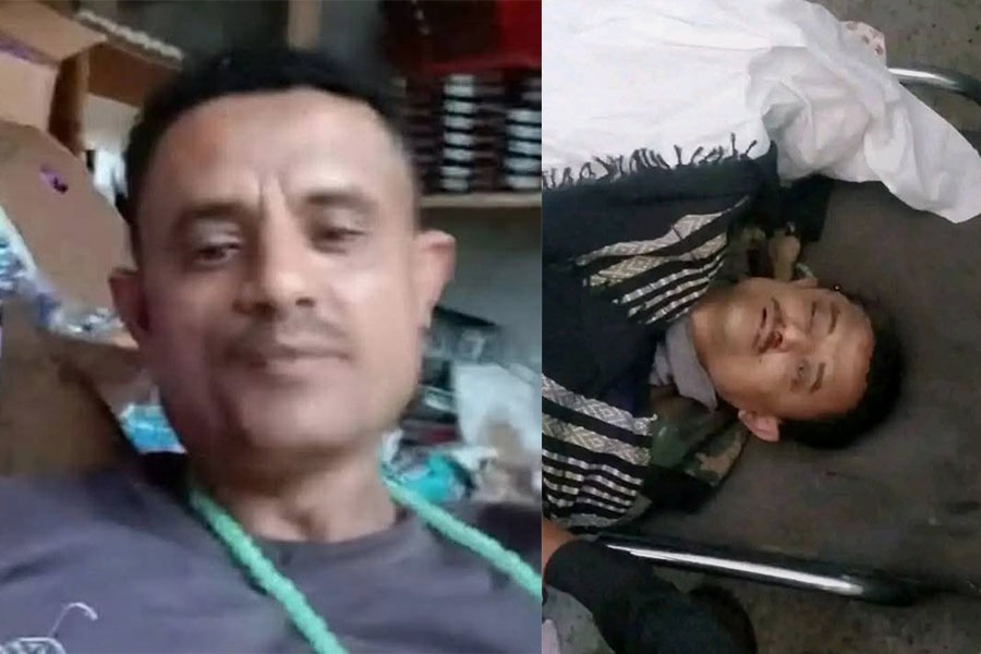 مصاد محلية لـ"تعز تايم" قتيل وثلاثة جرحى جراء إنفجار قنبلة شمال غربي تعز