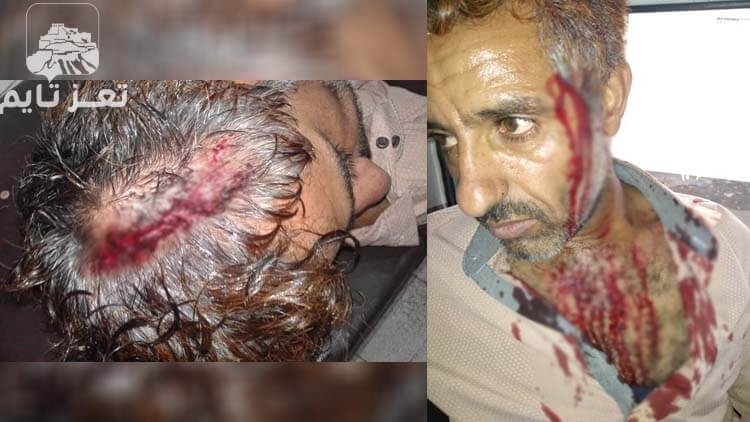 الاعتداء على فني كهرباء مستشفى الثورة بتعز لمحاولته منع توصيل التيار خارج المشفى