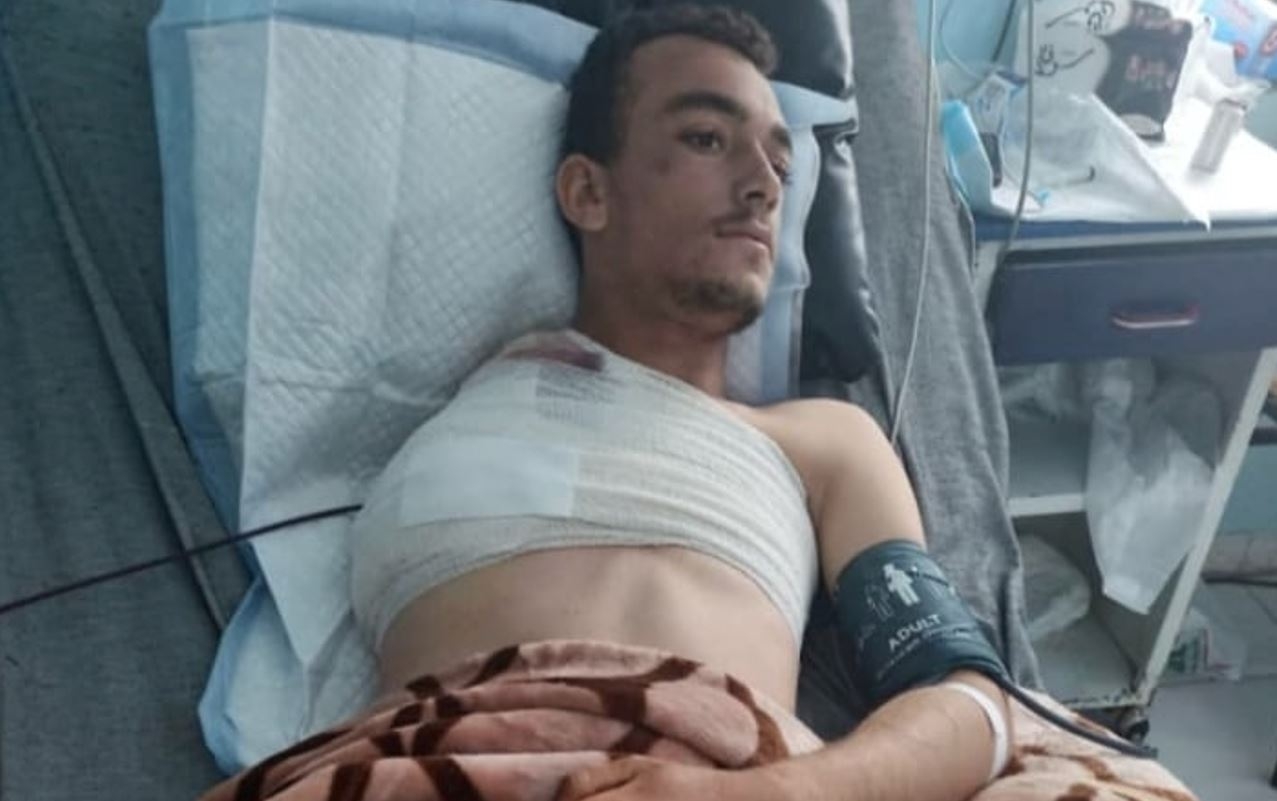 تعز.. شاب في شركة البحر الأحمر يفقد يده أثنا عمله