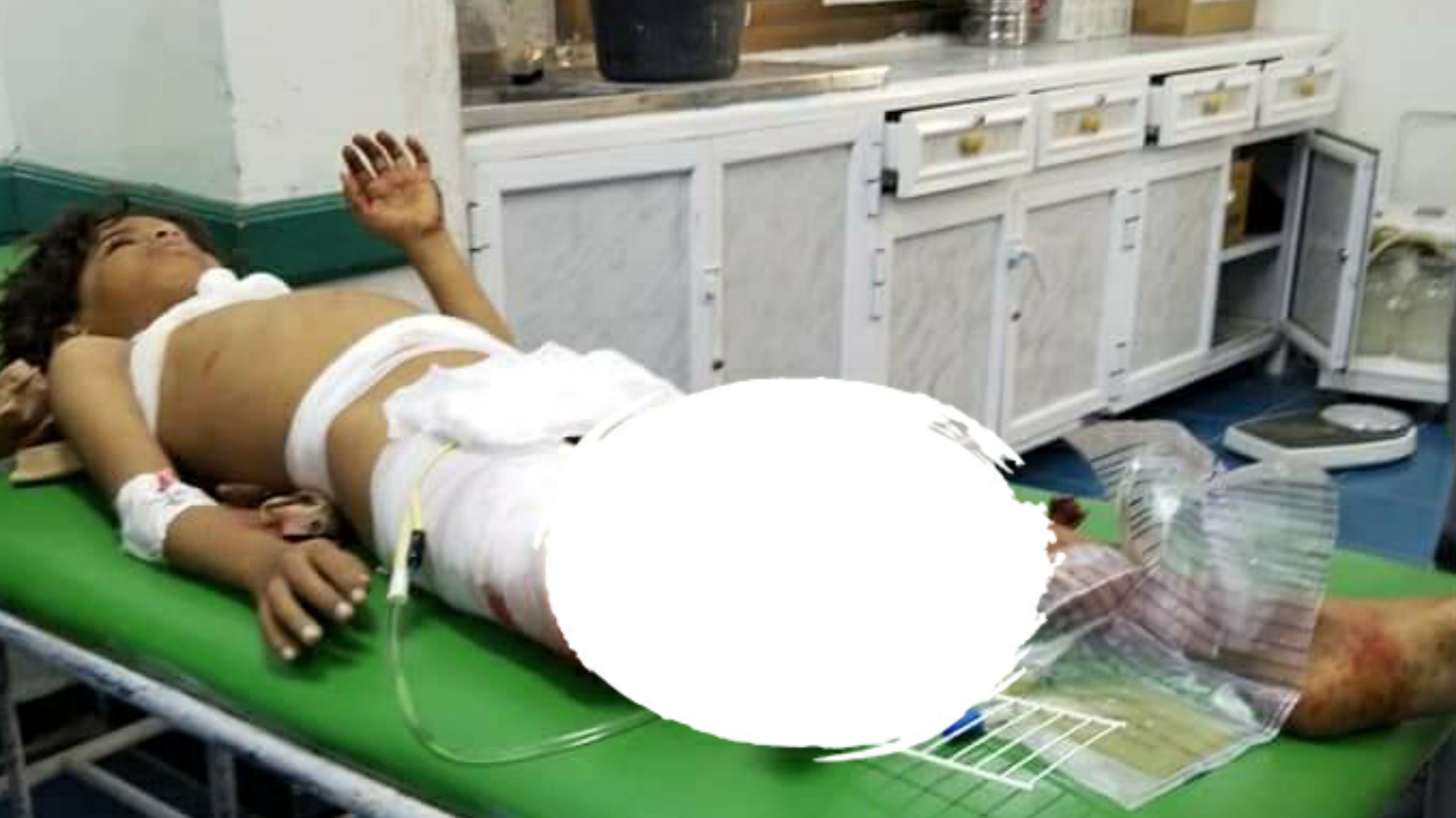 إصابة 3 أطفال بقذيفة للحوثيين غربي تعز