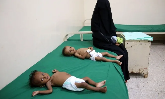 الأمم المتحدة: وفاة 6 أطفال من حديثي الولادة في اليمن كل ساعتين